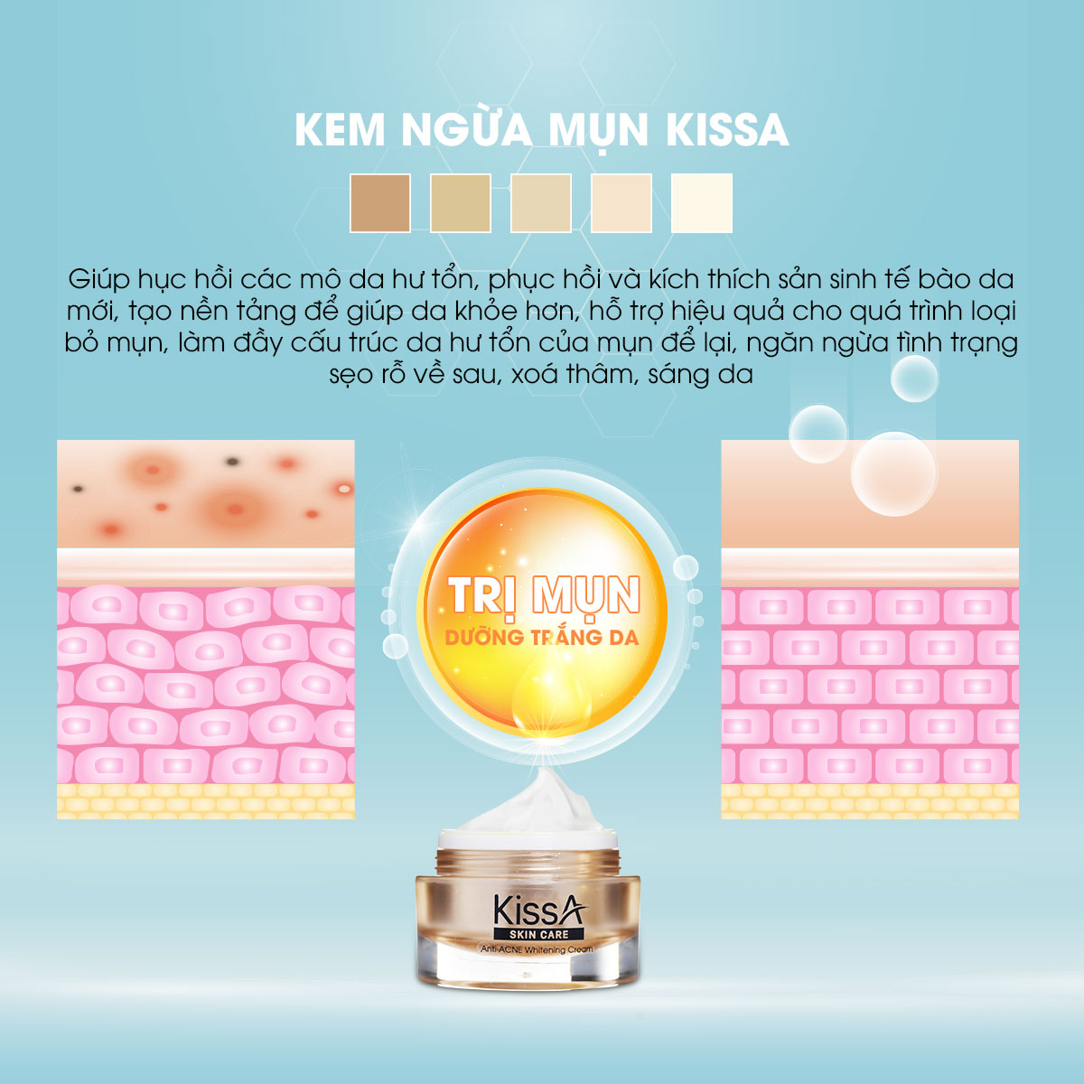 kem-ngua-mun-kissa-12