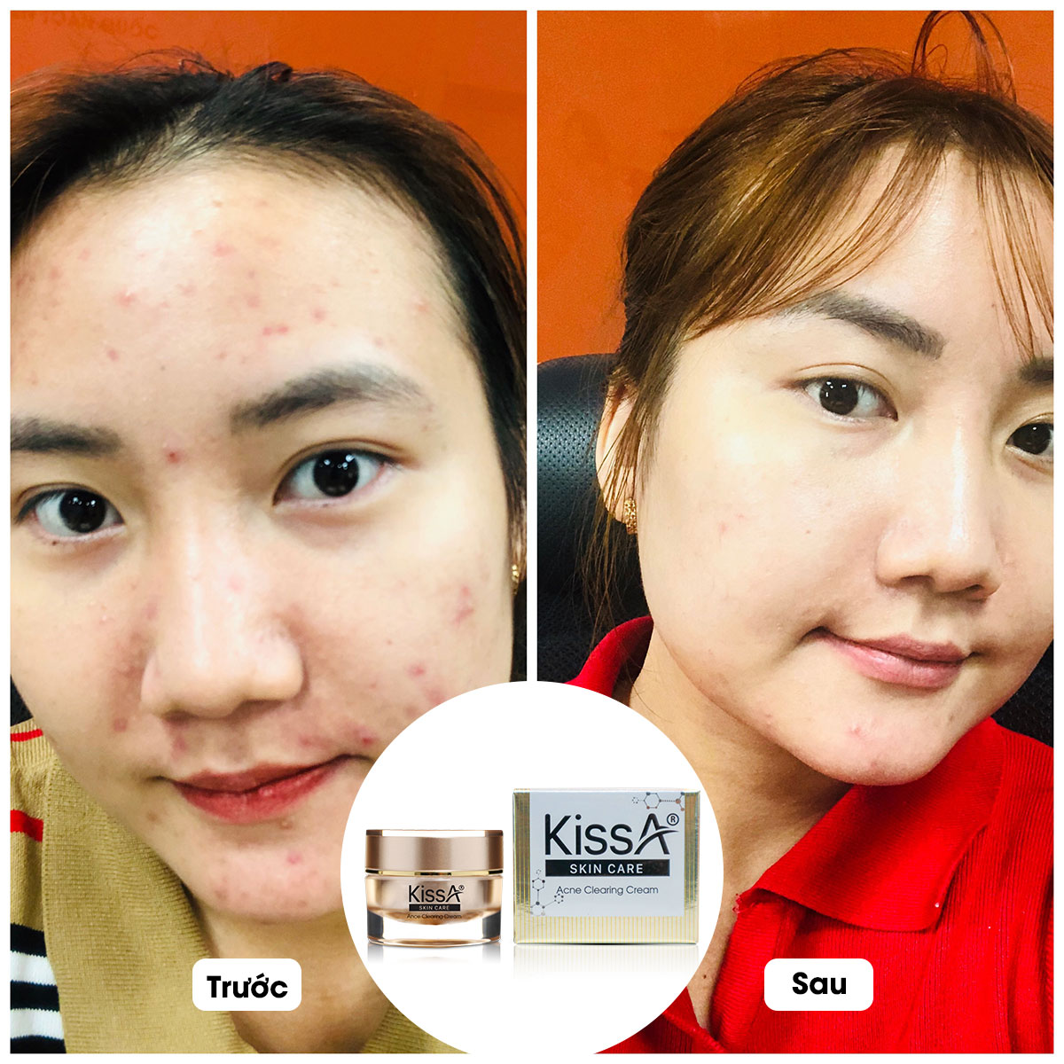 kem-ngua-mun-kissa-5