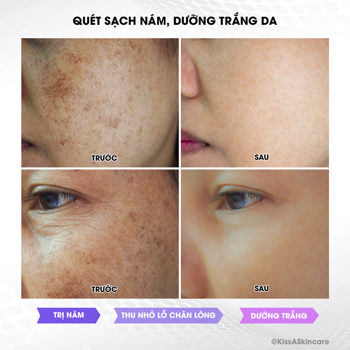 kem-ngua-nam-kissa-3